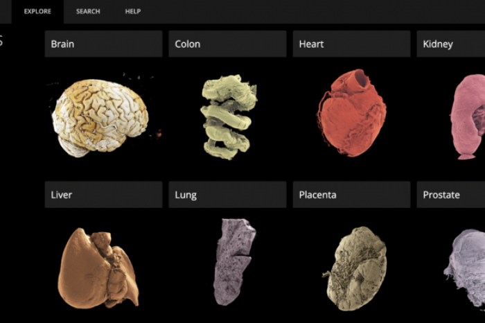 The Google Earth of the human body: online a journey through human organs like you have never seen before